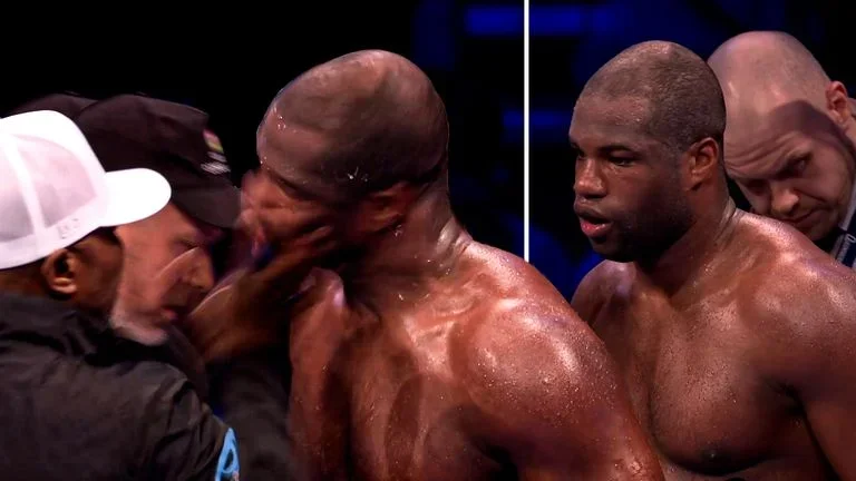Boxing